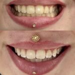 Whitening Bar NYC - Photo 4