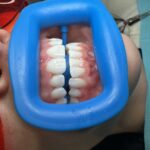 Whitening Bar NYC - Photo 7