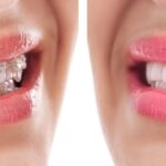 Implant Dental Works - Photo 3