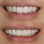 Manhattan Dental Design: Ernest Tchoi, DMD - Photo 2