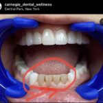 Carnegie Dental Wellness: Constantina Bacopoulou, DDS - Photo 6
