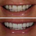 Cosmetic Dental Studios - Victoria Veytsman DDS - Photo 2