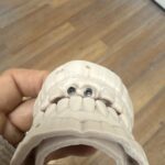 Creodent Prosthetics NYC - Photo 6