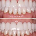 Wall Street Dental Spa - Financial District - Photo 3