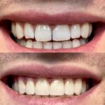 West 10th Dental, P.C. - Photo 2