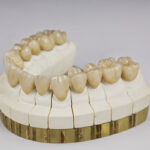 JL Dental Lab - Photo 2