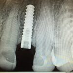 The Smilist Dental Manhattan - Photo 5