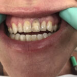 Michael A. Horvath DDS - Photo 5