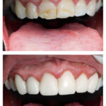 Ebenezer Dental - Photo 7