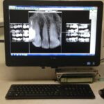 Lawrence Spindel DDS - Photo 4