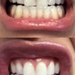 Armstrong Dental Studio - Photo 6