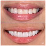 Smiles of NYC - Michael Kosdon DDS - Photo 3