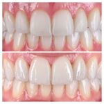 Smiles of NYC - Michael Kosdon DDS - Photo 5