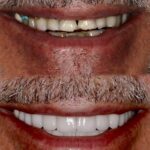 Smiles of NYC - Michael Kosdon DDS - Photo 7