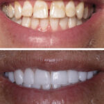 Smile Center of NY - Photo 2