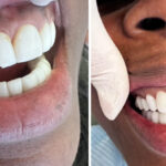 Smile Center of NY - Photo 3