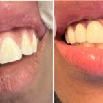 Smile Center of NY - Photo 5