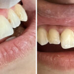 Smile Center of NY - Photo 6