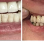 Smile Center of NY - Photo 7