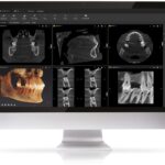 Oral Surgery - All Insurances Accepted - Photo 3