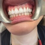 Dr. Tristan Lue - New York Dentist - Photo 5