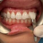 Dr. Tristan Lue - New York Dentist - Photo 7