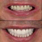 FaktorDMD Cosmetic Dentistry & Implants - NYC - Photo 2