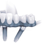 OLD CLOSED DENTAL LOCATION - Photo 2