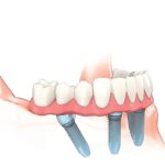 OLD CLOSED DENTAL LOCATION - Photo 5