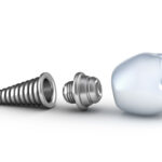 Dental Office 10017 | Dentist | General Dentist - Photo 4