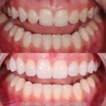 Sutton Advanced Cosmetic Dentistry - Photo 2