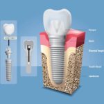 Rubin Dental & Implant Center - Photo 4