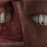 Brooklyn Heights Dental: Eugene D. Stanislaus, DDS - Photo 7