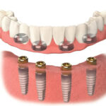 DPI Dental - Photo 7