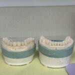 VIP Smiles by Dr. Catrise Austin – No-Prep Veneers Midtown NYC - Photo 3