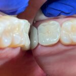 PreserveYourTeeth - Dentistry Alice Urbankova DDS, PhD - East Setauket, Long Island - Photo 2