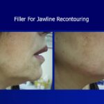 Novick Nelson - Photo 5