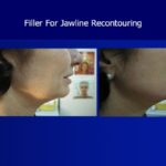 Novick Nelson - Photo 6