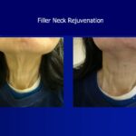 Novick Nelson - Photo 7