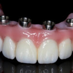 ASA Dental Lab - Photo 1