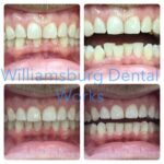 Williamsburg Dental Works - Photo 2