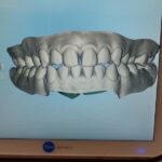 Smile Direct Club - Photo 3