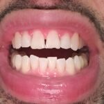 Smile Direct Club - Photo 4