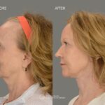 Advanced Facial Surgery: Manolis Manolakakis, DMD, FACS - Photo 7