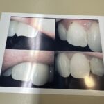 Staten Island Dental Care - Dr. Frederick Hecht, MAGD - Photo 4