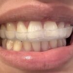 Park Slope Dentistry - Photo 1