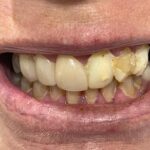 ACE dental - Photo 2