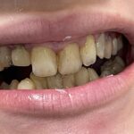 ACE dental - Photo 4