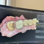 Seneca Ridge Dental - Photo 5