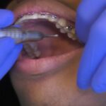 Suburban Orthodontics - Photo 7